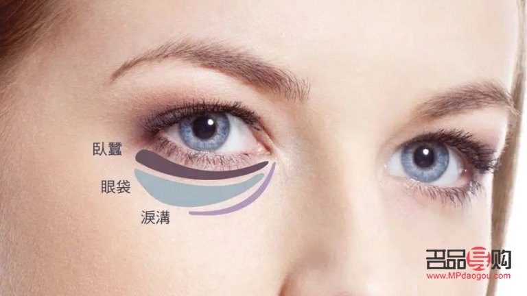 <h3>探究眼袋形成之谜:成因、影响与解决方案</h3> <h3>探究眼袋形成之谜:成因、影响与解决方案</h3>