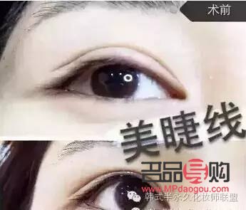 <h3>内双纹眼线与美瞳线，哪个更具魅力？</h3>