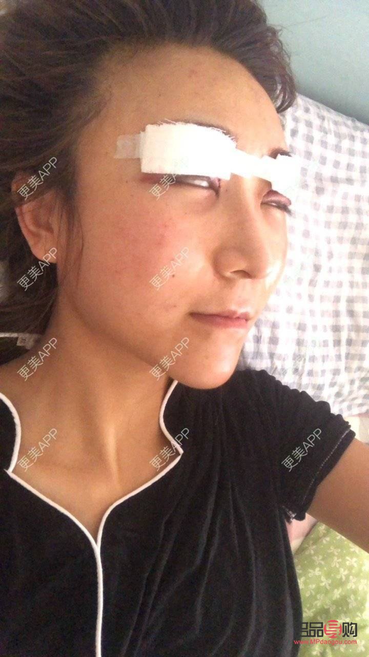 <h3>西安市双眼皮整形优选之地</h3>