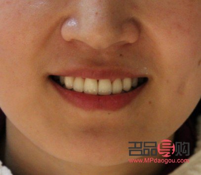 <h1>牙齿美容:绽放自信笑容的秘密武器</h1> <h1>牙齿美容:绽放自信笑容的秘密武器</h1>