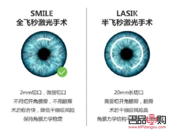 凸眼球矫正手术多少钱(凸眼球矫正手术多少钱) 凸眼球矫正手术多少钱(凸眼球矫正手术多少钱)