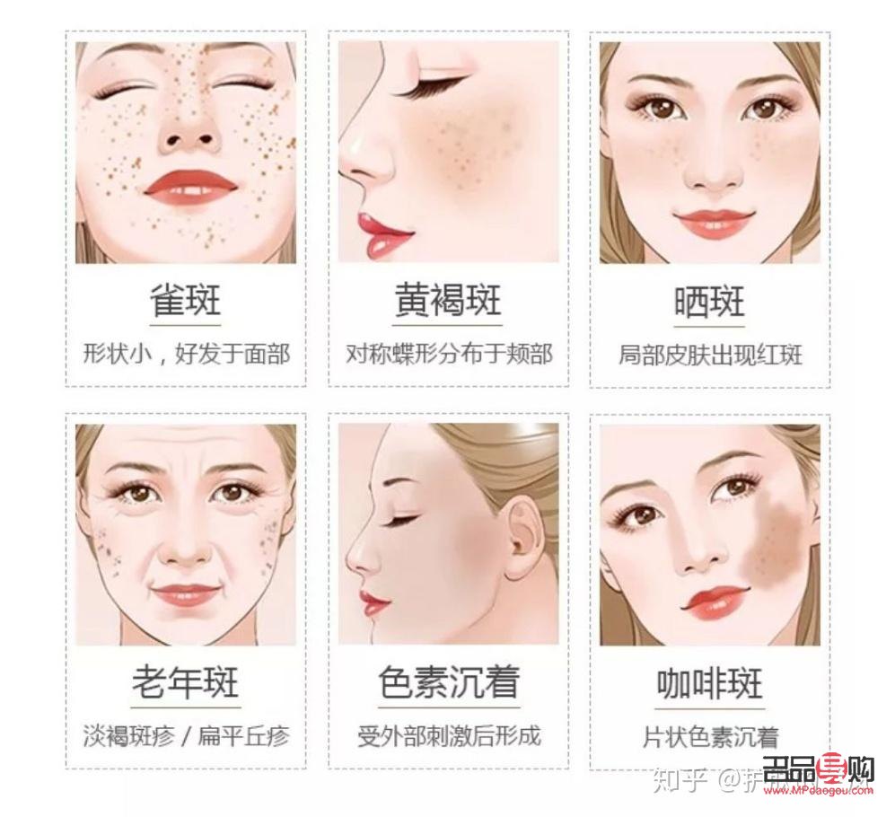 美容祛斑好吗(美容祛斑好吗知乎)