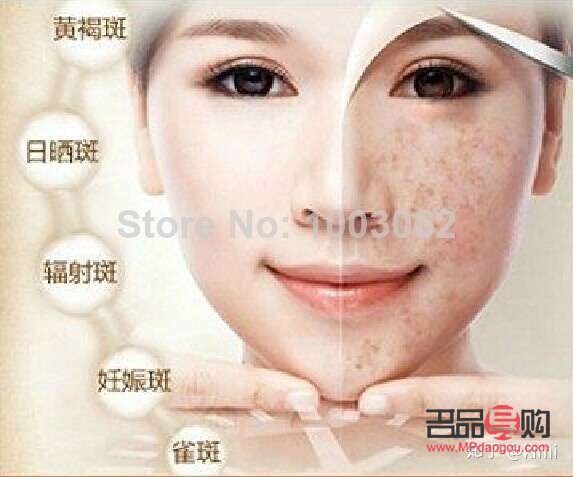 美容祛斑好吗(美容祛斑好吗知乎)