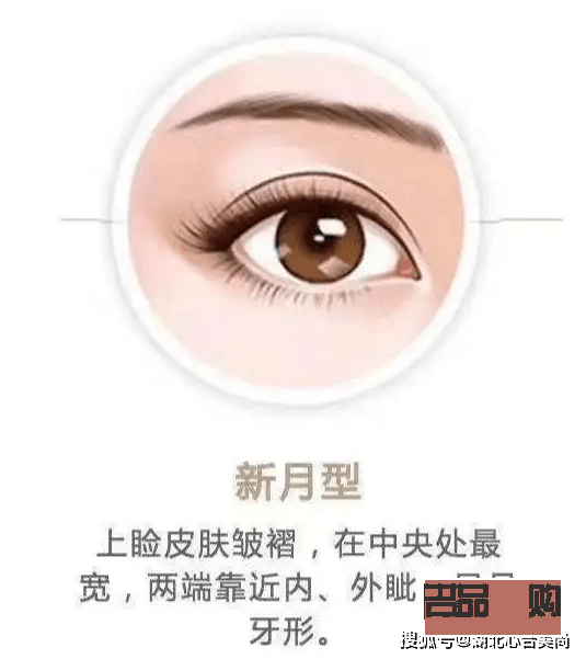 新月型双眼皮与平扇形双眼皮的区别