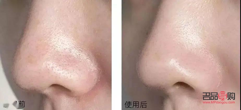 <h3>眼部保养手法:呵护明眸,告别岁月痕迹</h3> <h3>眼部保养手法:呵护明眸,告别岁月痕迹</h3>