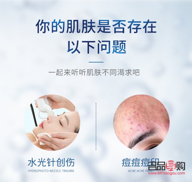 <h3>医疗美容祛痘全攻略：告别痘痘，重拾无瑕肌肤</h3>