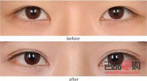 <h3>探索8毫米开扇双眼皮的魅力</h3> <h3>探索8毫米开扇双眼皮的魅力</h3>