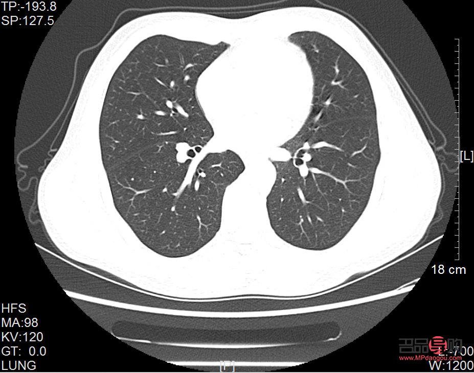 去黑眼圈的土方法(去黑眼圈的土方法黑眼圈严重去检查挂什么科)