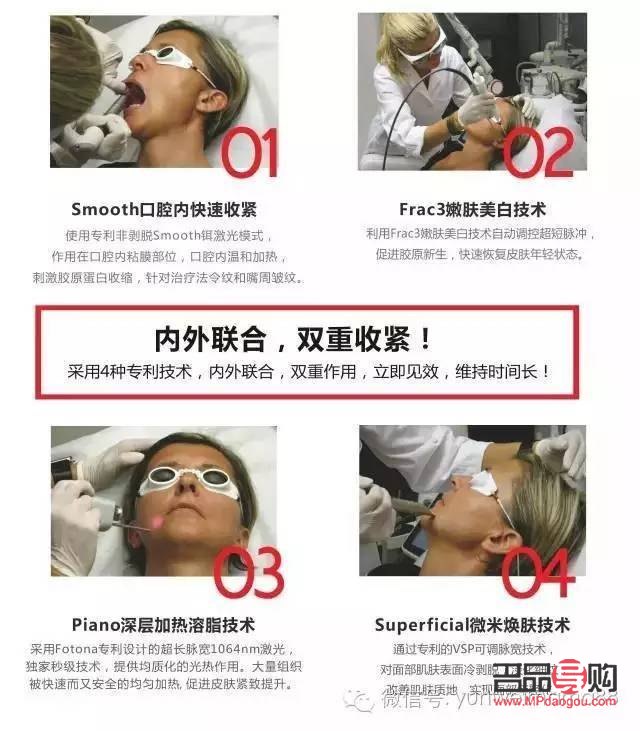 fotona眼部抗衰299套餐(fotona和超声炮的区别)