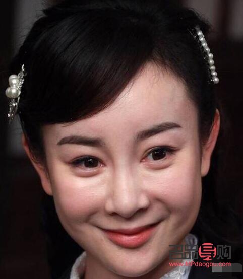 眼下八字泪沟怎么去除(眼下八字泪沟怎么去除图片)