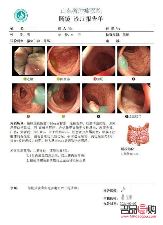 美容院割息肉疼吗——专业解读疼痛感受与缓解方法