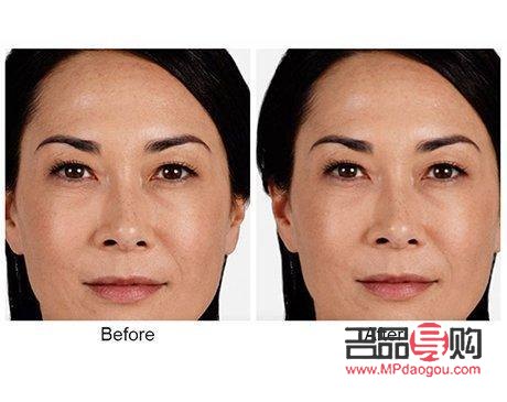 <h3>眼尾下垂图片：解读眼部衰老迹象及改善方法</h3>