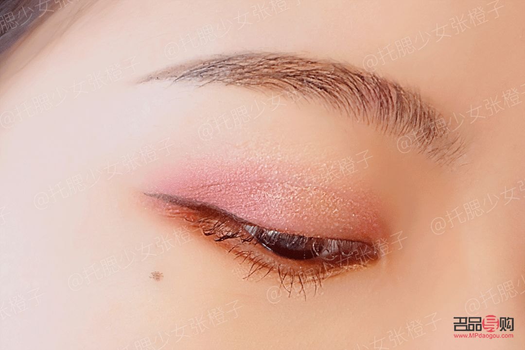 探索子双眼皮手术：打造迷人双眼的秘密武器