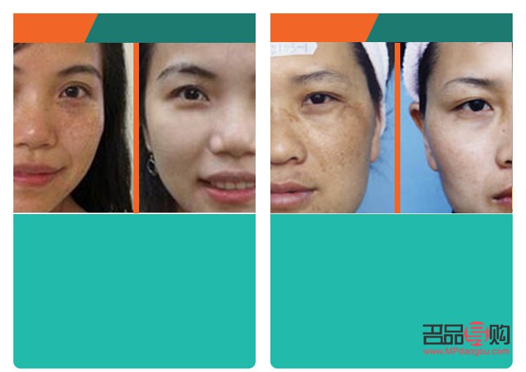 <h3>哪个美容院祛斑好？专业祛斑，重拾肌肤光彩</h3>