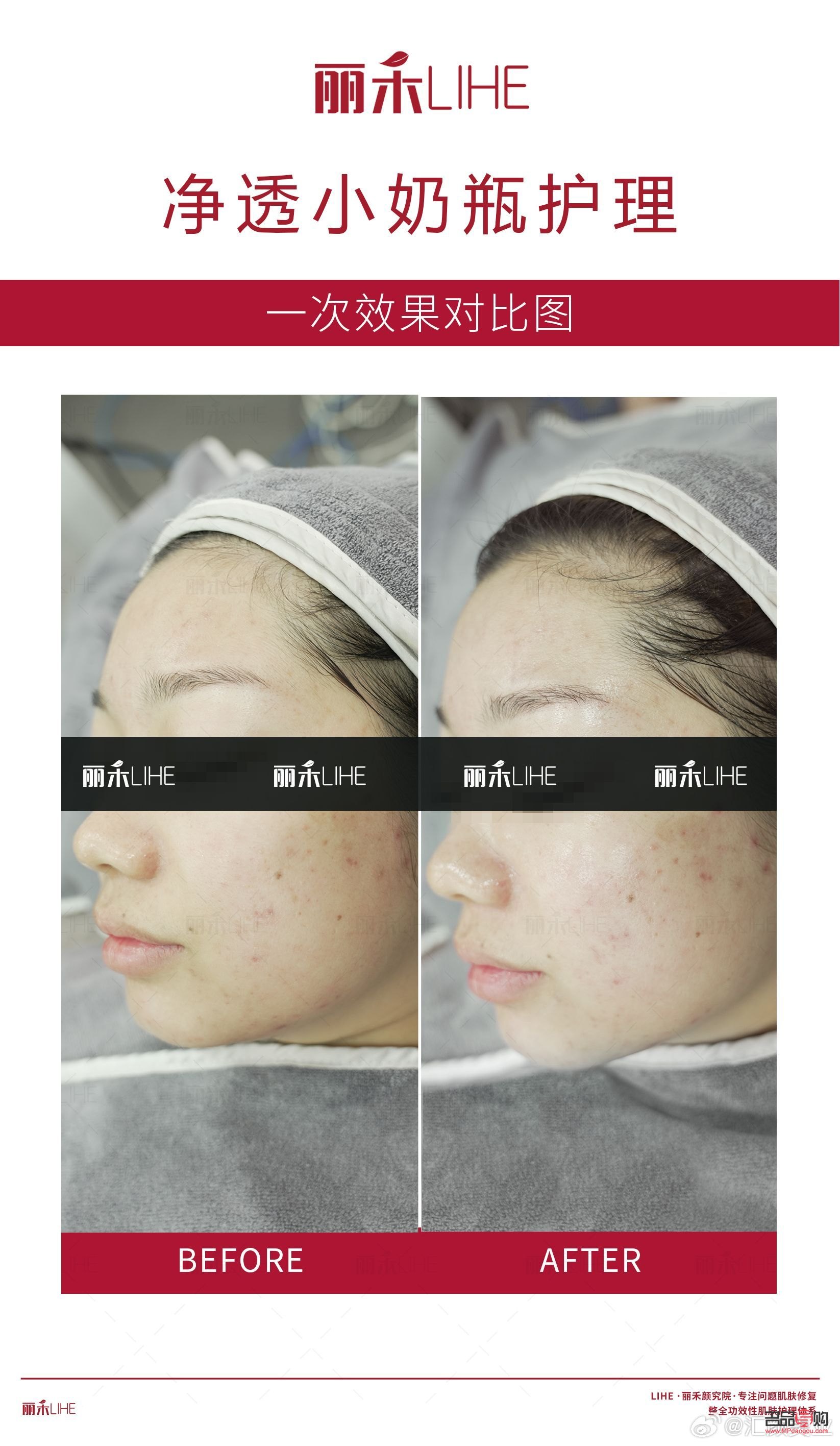 <h3>哪个美容院祛斑好？专业祛斑，重拾肌肤光彩</h3>