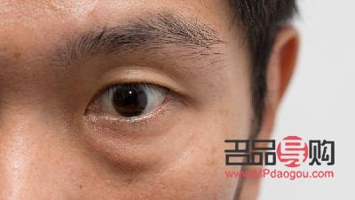 男士去眼袋黑眼圈用什么(男士去眼袋黑眼圈用什么产品效果比较好)