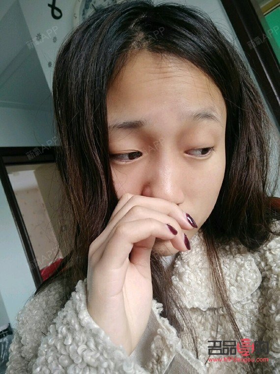 <h3>打了除皱针眼皮下垂能恢复嘛</h3> <h3>打了除皱针眼皮下垂能恢复嘛</h3>