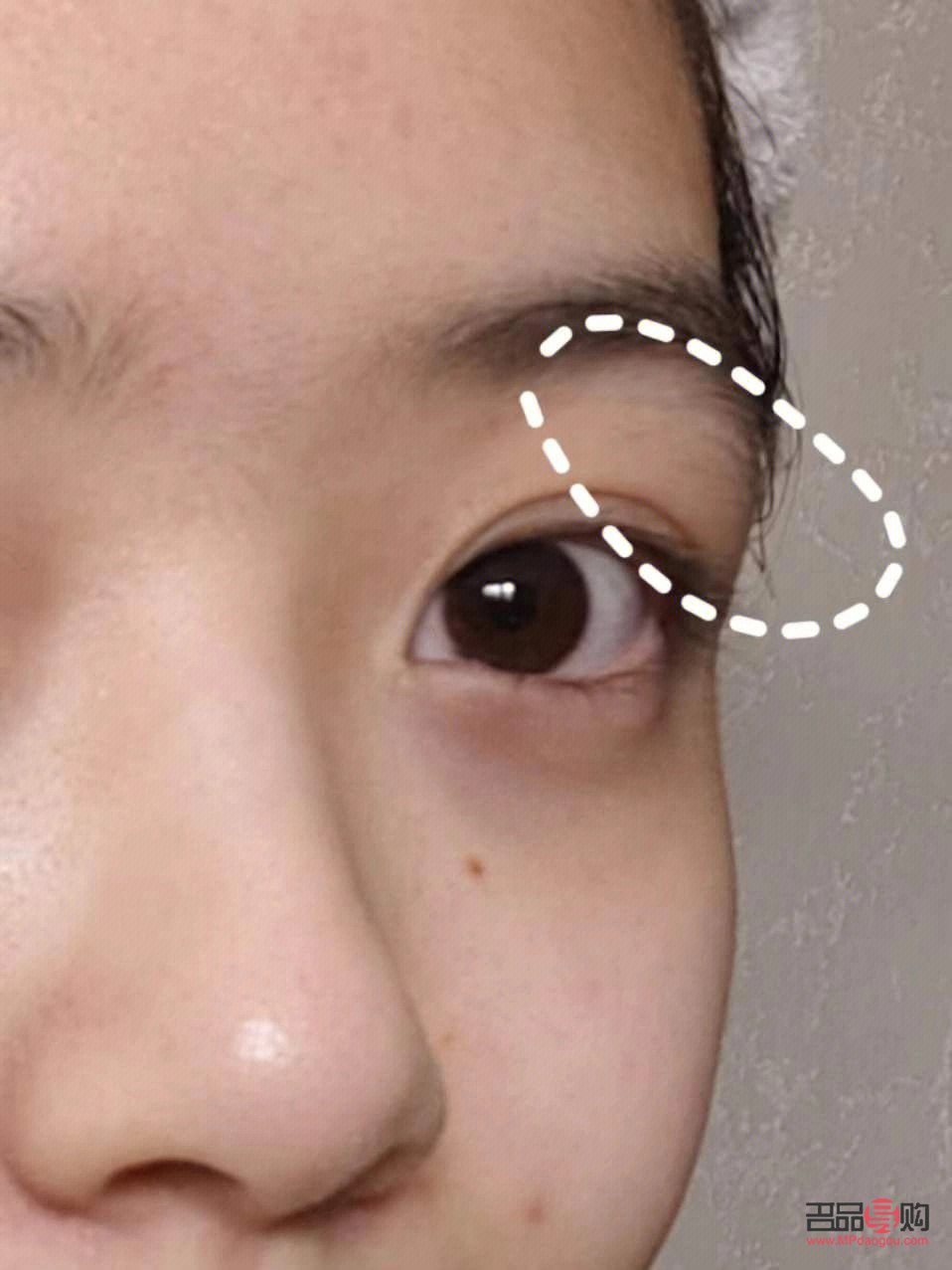 上眼皮肿眼泡怎么消除用啥中成药(上眼皮肿眼泡怎么消除用啥中成药好) 上眼皮肿眼泡怎么消除用啥中成药(上眼皮肿眼泡怎么消除用啥中成药好)