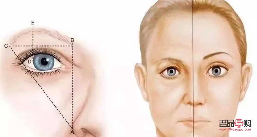 <h3>双眼皮提眉与割双眼皮:哪种更适合你?</h3> <h3>双眼皮提眉与割双眼皮:哪种更适合你?</h3>