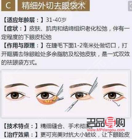 内切眼袋可以维持几年(内切眼袋可以维持几年寿命) 内切眼袋可以维持几年(内切眼袋可以维持几年寿命)