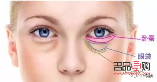 <h3>卧蚕与眼袋的区别详解</h3>