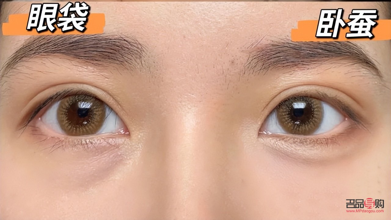 卧蚕和眼袋有什么区别面相图片(卧蚕和眼袋有什么区别面相图片女)