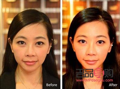 如何改善大小眼除了整形(有什么方法可以改善大小眼) 如何改善大小眼除了整形(有什么方法可以改善大小眼)