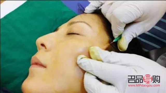 线雕美容好吗：解析线雕美容的优劣与选择