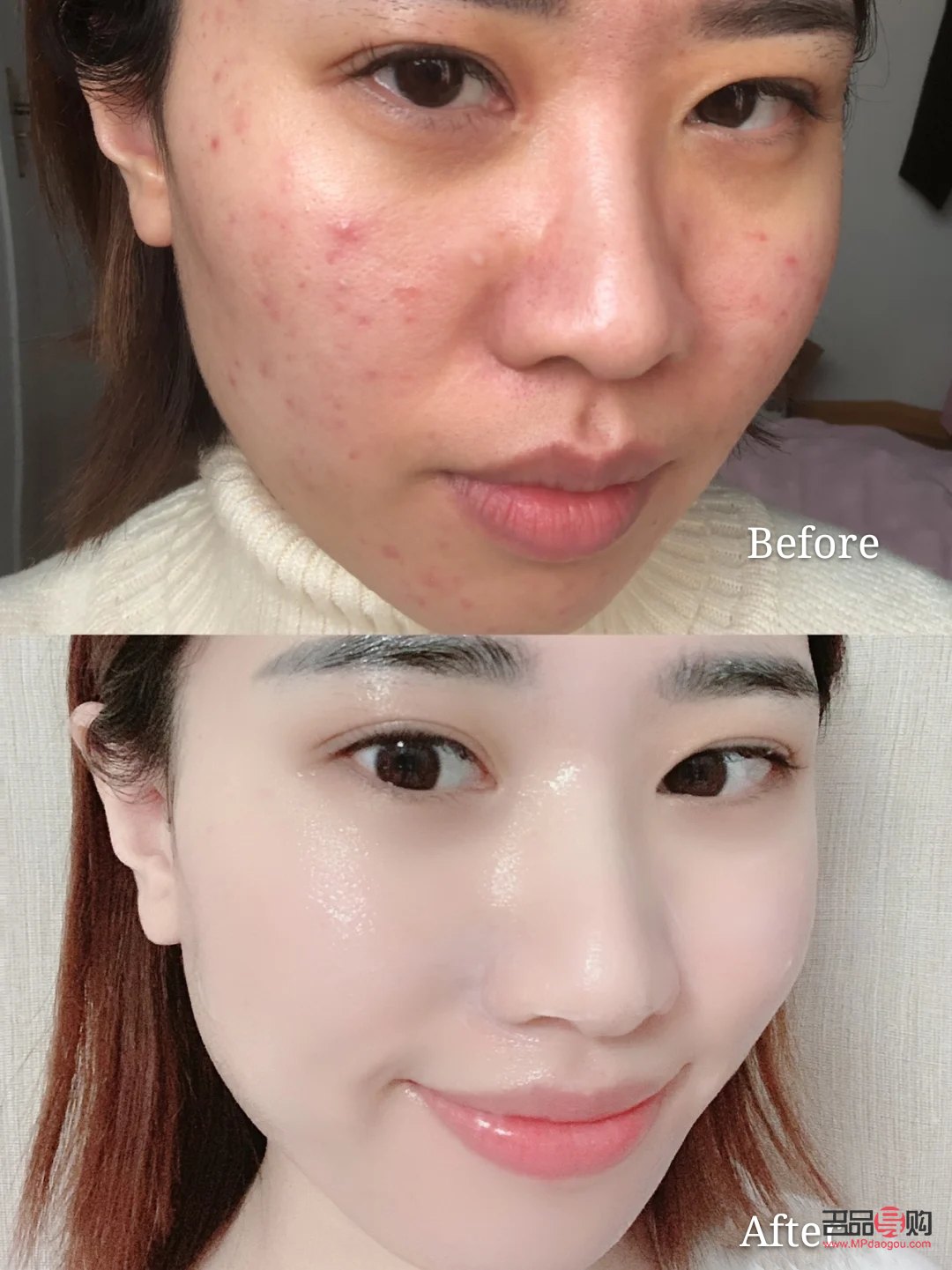 学美容手要疼多久(学美容手要疼多久才不疼)