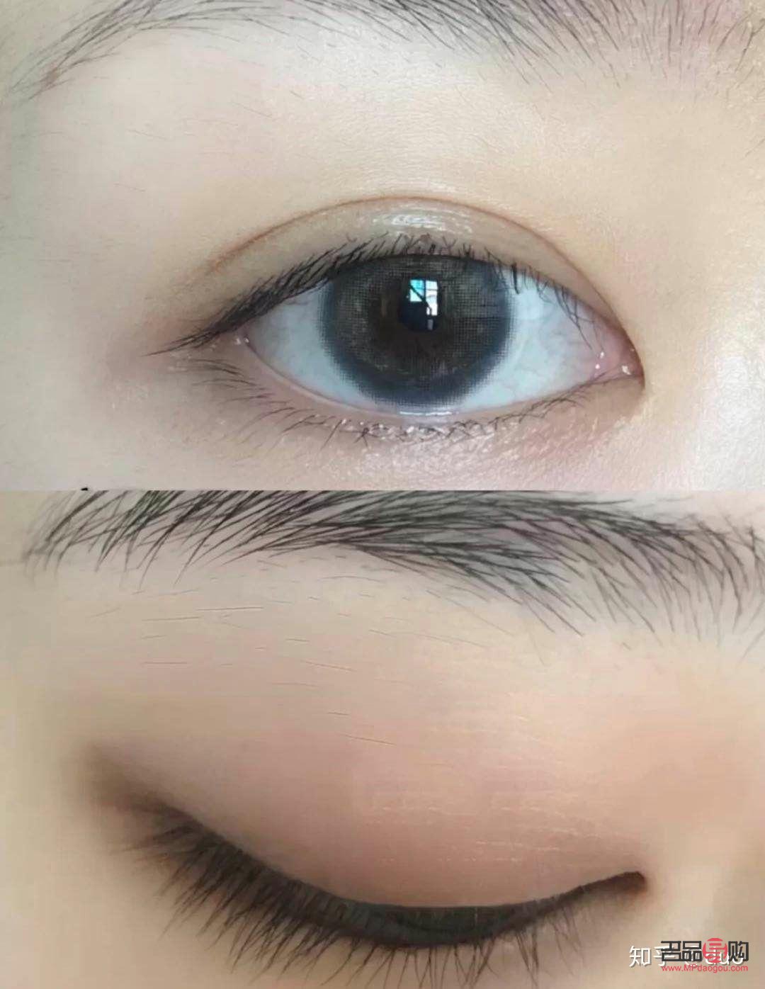 做双眼皮眼综合大概多少钱(做双眼皮眼综合大概多少钱一次) 做双眼皮眼综合大概多少钱(做双眼皮眼综合大概多少钱一次)