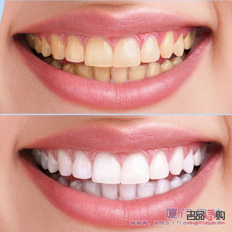 <h3>牙齿美容怎么办</h3>