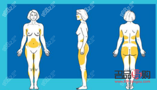 做了抽脂如何护理身体(做了抽脂如何护理身体好)