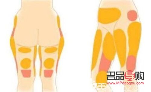 做了抽脂如何护理身体(做了抽脂如何护理身体好)