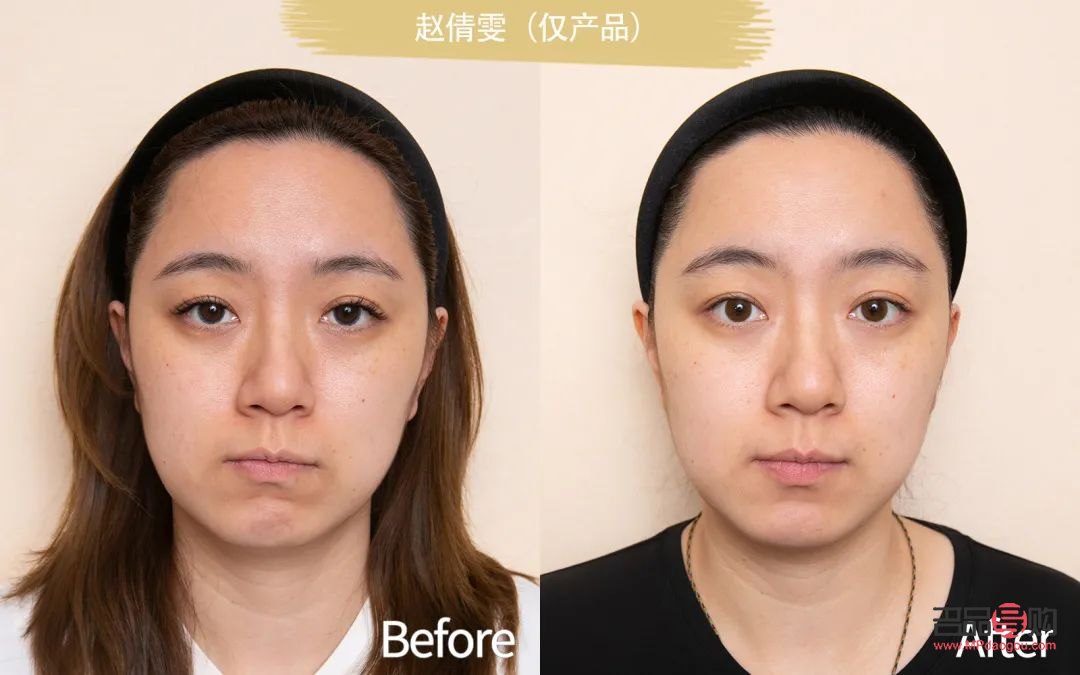 <h3>眼袋加泪沟综合手术多少钱？全面解析手术费用及影响因素</h3>