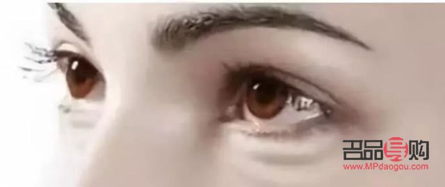 <h3>怎么有效去除黑眼圈眼袋</h3> <h3>怎么有效去除黑眼圈眼袋</h3>