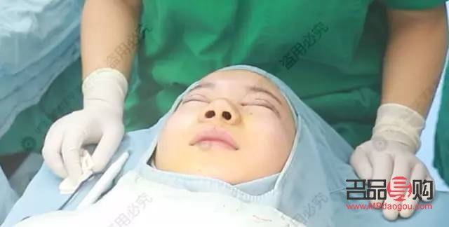 做双眼皮具备的条件(做双眼皮具备的条件是什么) 做双眼皮具备的条件(做双眼皮具备的条件是什么)