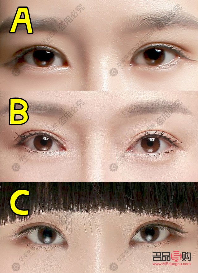 做双眼皮具备的条件(做双眼皮具备的条件是什么)