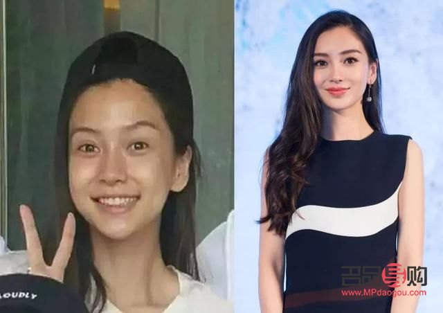 双眼皮肉条太厚能修复吗(双眼皮肉条太厚能修复吗图片)