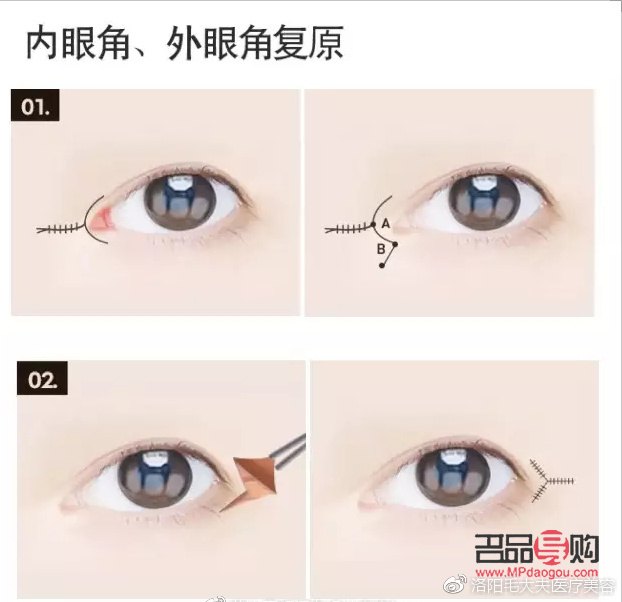 小眼综合包括哪些项目图片(小眼综合包括哪几项)