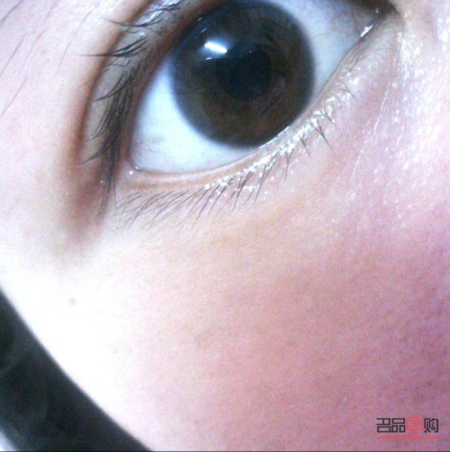 <h3>眼皮有皱纹什么原因</h3>