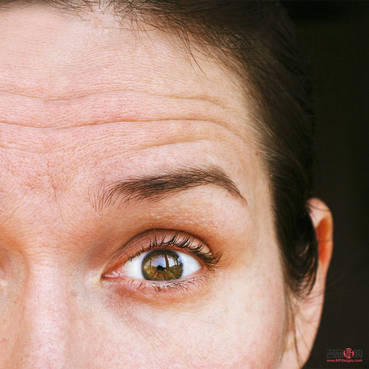 <h3>眼皮有皱纹什么原因</h3>