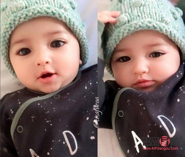 眼皮变松了能自己恢复吗？专业解答与实用建议