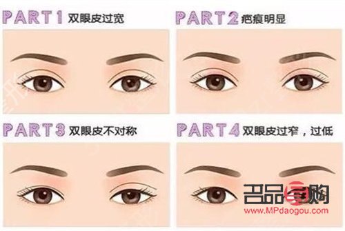 双眼皮什么形状的好看(双眼皮什么形状的好看一点) 双眼皮什么形状的好看(双眼皮什么形状的好看一点)