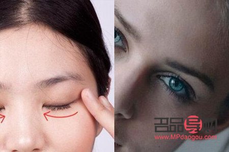 <h3>眼角下垂怎么提升和紧致眼角</h3>