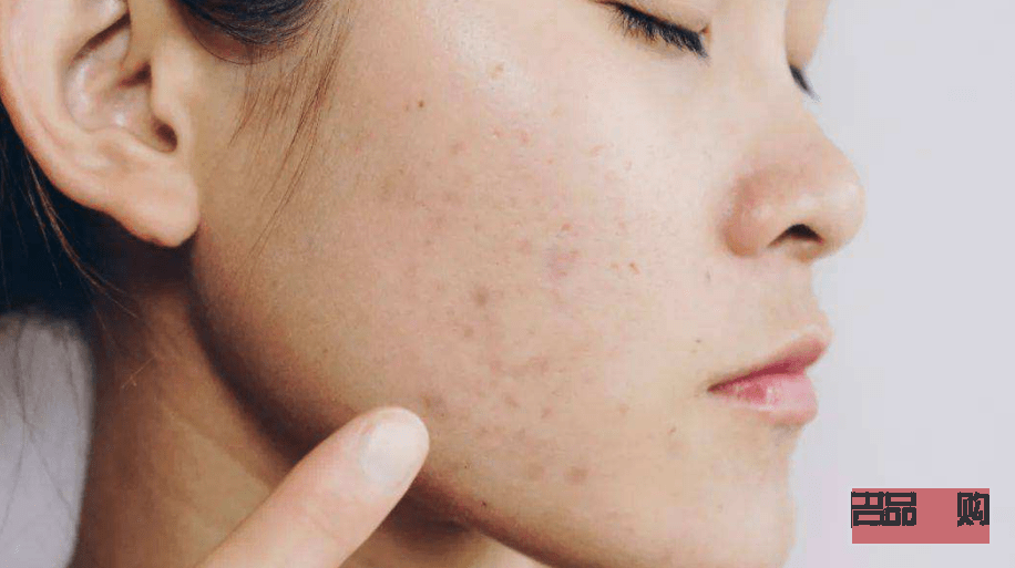 身体过敏护理油哪种好(身体过敏护理油哪种好用)