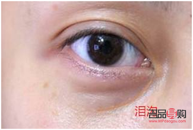 怎么样保养眼睛不产生眼袋和泪沟(怎么样保养眼睛不产生眼袋和泪沟的方法)