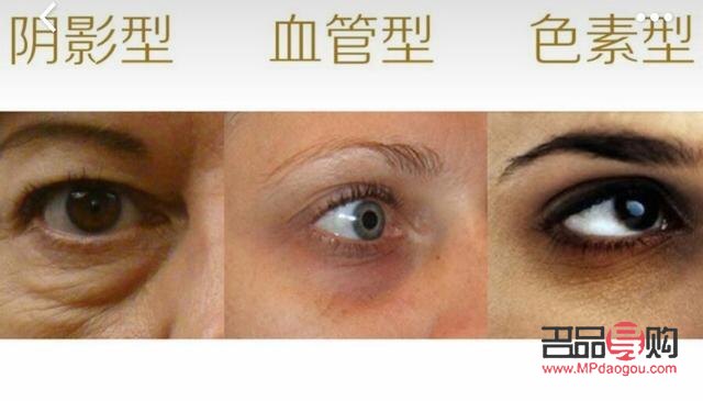 怎么样保养眼睛不产生眼袋和泪沟(怎么样保养眼睛不产生眼袋和泪沟的方法)