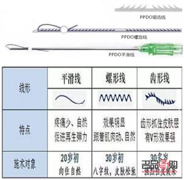 美容线分什么型号(美容线分什么型号好) 美容线分什么型号(美容线分什么型号好)