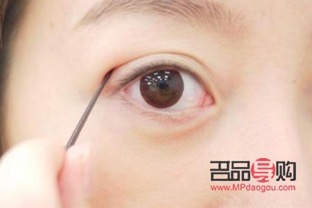 割双眼皮手术多久恢复(割双眼皮手术多久恢复正常)