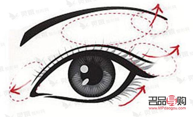 双眼皮扇形和平扇的区别图片(双眼皮扇形和平扇的区别图片对比)